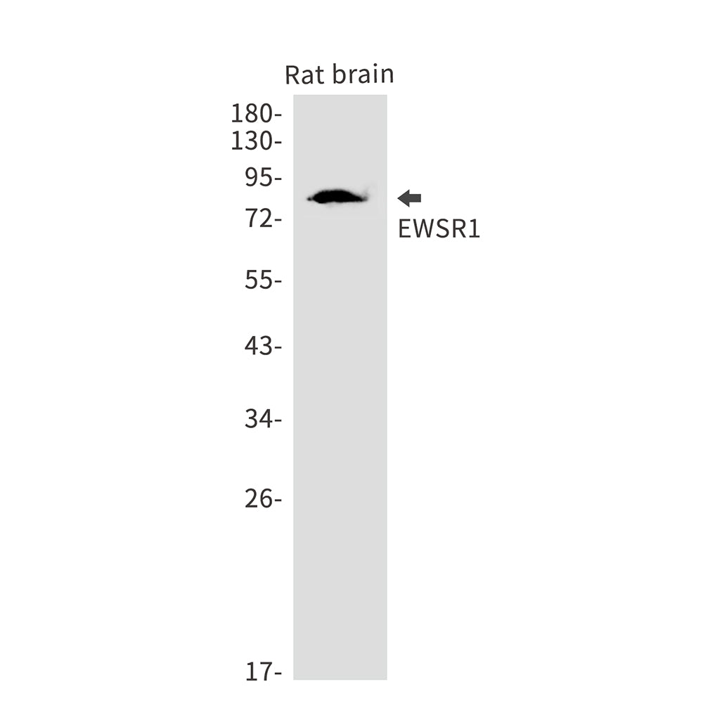 EWSR1 Rabbit Monoclonal Antibody