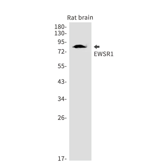 EWSR1 Rabbit Monoclonal Antibody