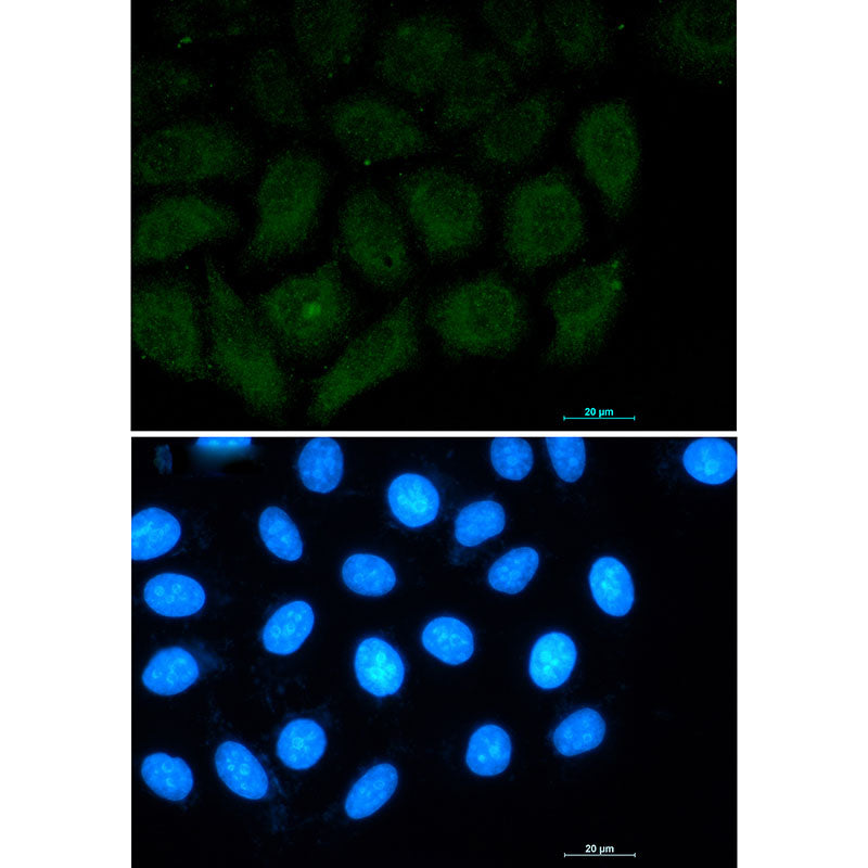 FAK Rabbit Monoclonal Antibody
