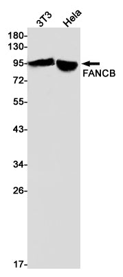 FANCB Rabbit Monoclonal Antibody