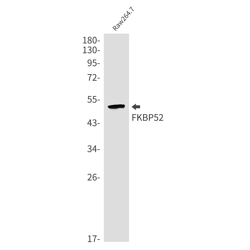 FKBP52 Rabbit Monoclonal Antibody