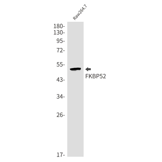 FKBP52 Rabbit Monoclonal Antibody