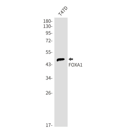 FOXA1 Rabbit Monoclonal Antibody