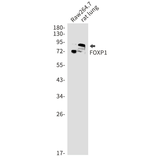 FOXP1 Rabbit Monoclonal Antibody
