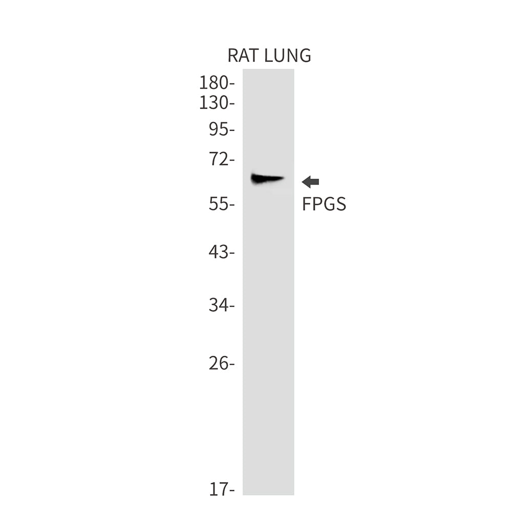 FPGS Rabbit Monoclonal Antibody
