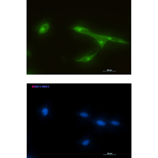 FRAT1 Rabbit Monoclonal Antibody