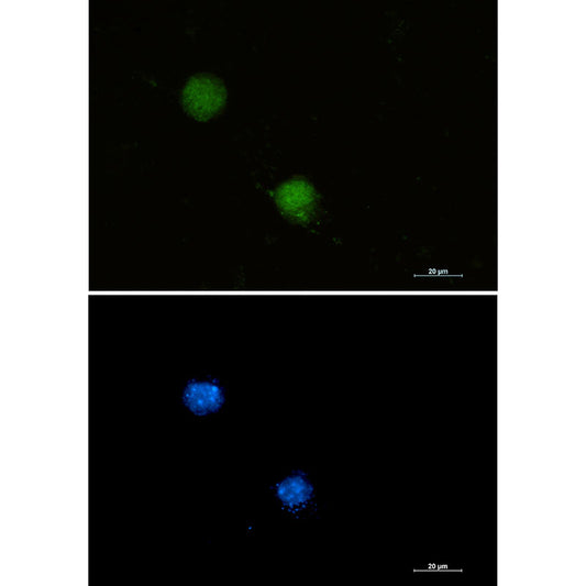FUBP1 Rabbit Monoclonal Antibody