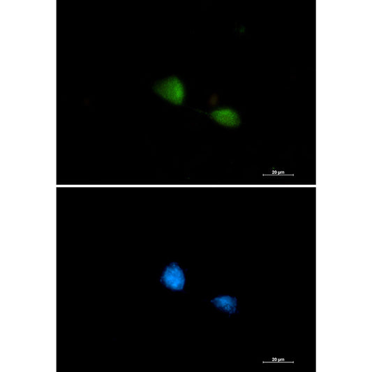 FUBP1 Rabbit Monoclonal Antibody