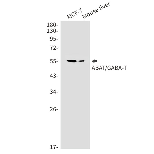 ABAT Rabbit Monoclonal Antibody