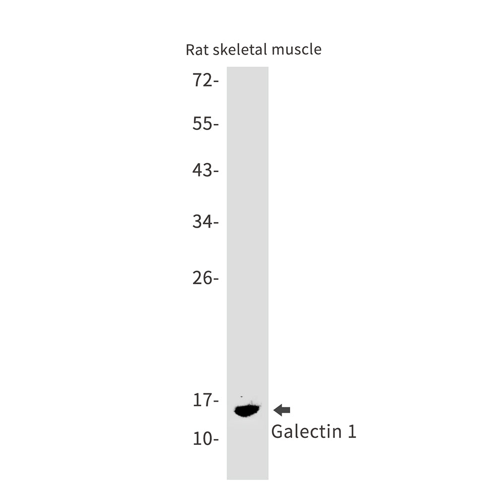 Galectin 1 Rabbit Monoclonal Antibody
