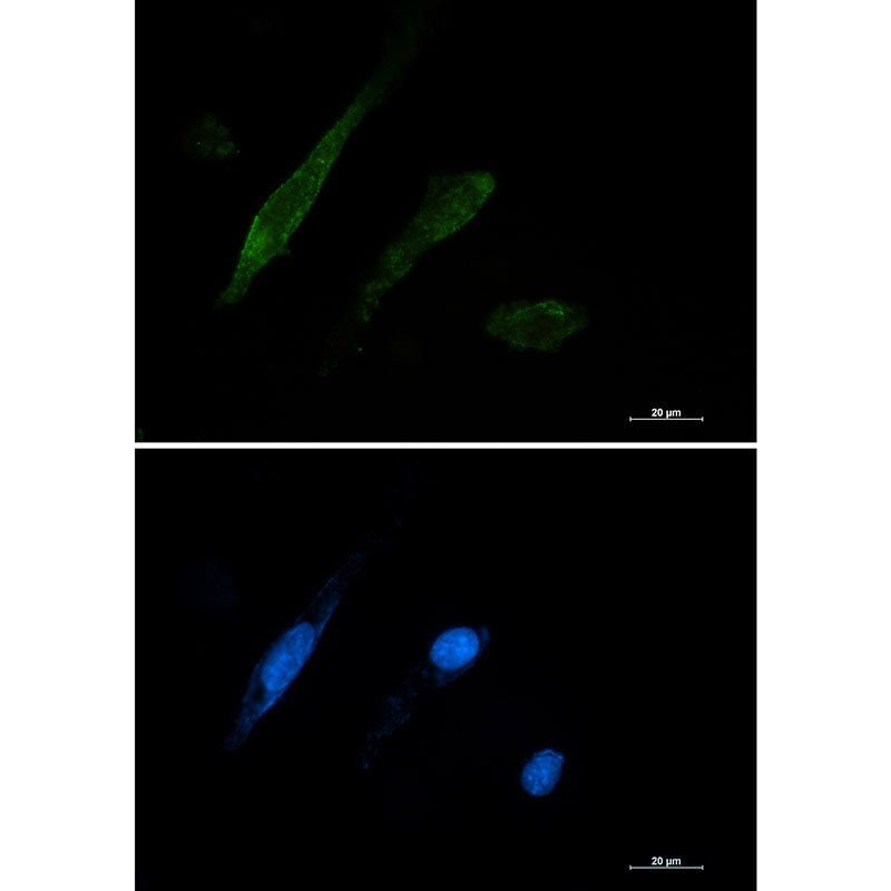 Galectin 3 Rabbit Monoclonal Antibody