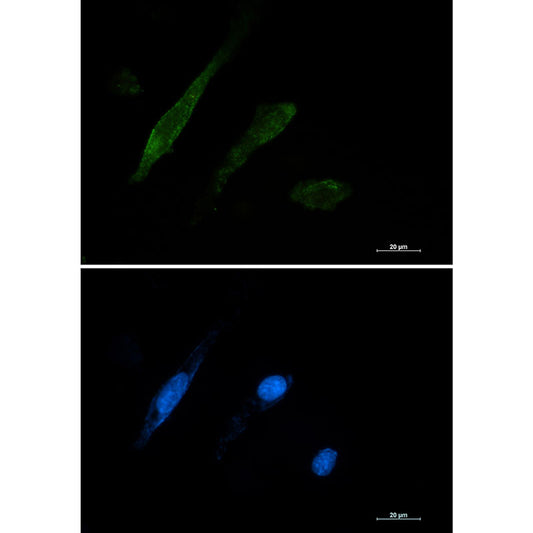 Galectin 3 Rabbit Monoclonal Antibody