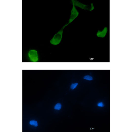GFPT2 Rabbit Monoclonal Antibody