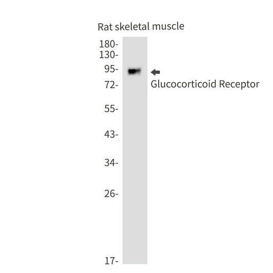 Glucocorticoid Receptor Rabbit Monoclonal Antibody