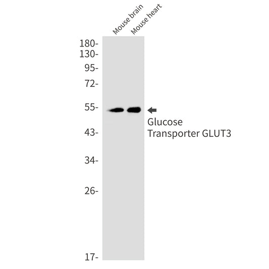 Glucose Transporter GLUT3 Rabbit Monoclonal Antibody
