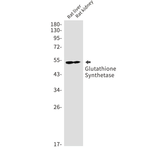 Glutathione Synthetase Rabbit Monoclonal Antibody
