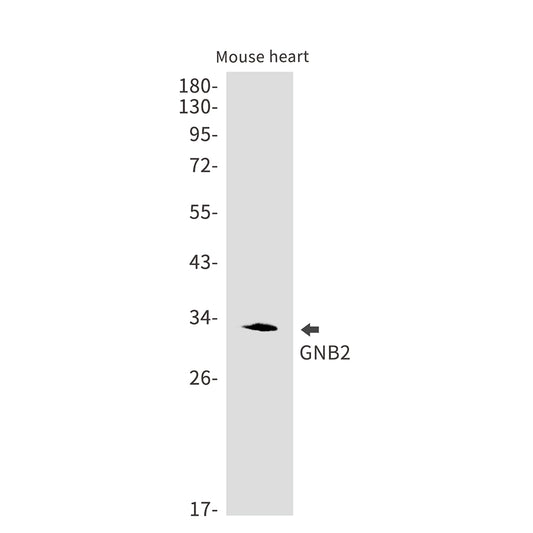 GNB2 Rabbit Monoclonal Antibody