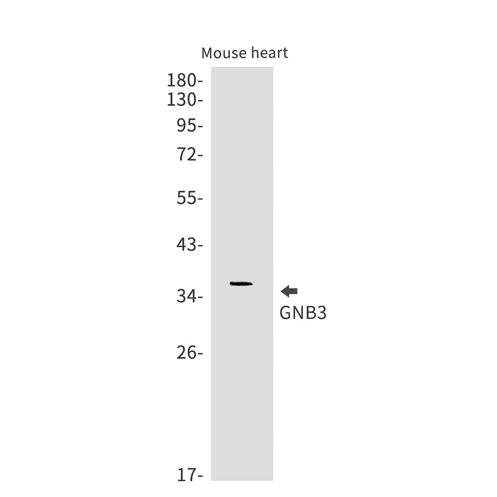 GNB3 Rabbit Monoclonal Antibody