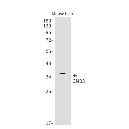 GNB3 Rabbit Monoclonal Antibody