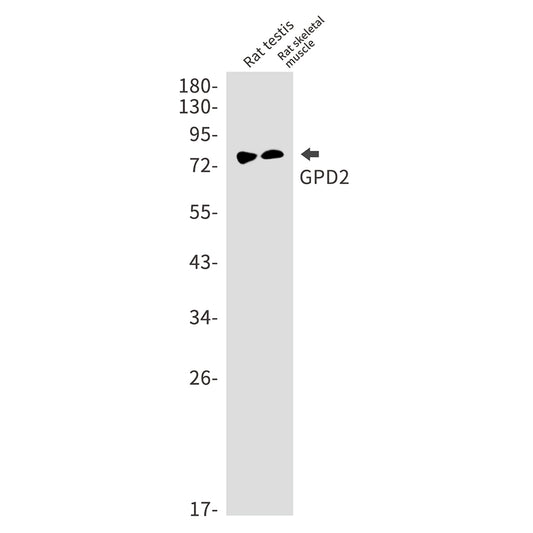 GPD2 Rabbit Monoclonal Antibody