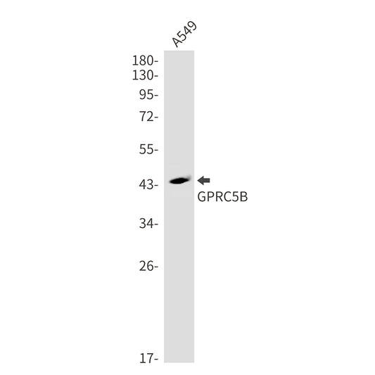 GPRC5B Rabbit Monoclonal Antibody