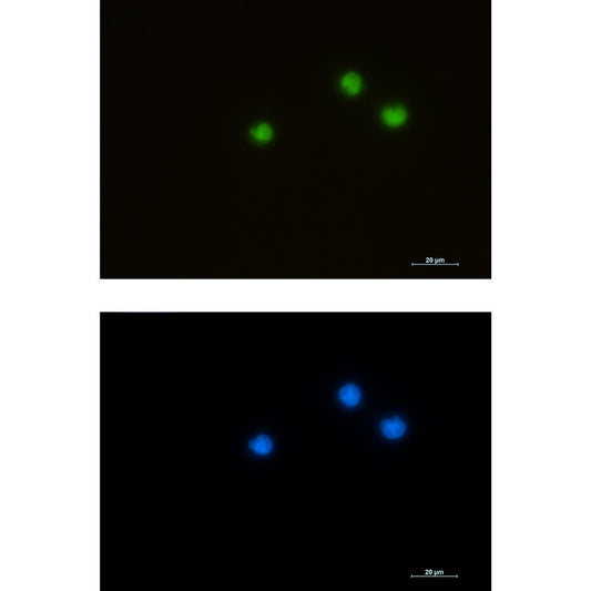 HDAC1 Rabbit Monoclonal Antibody
