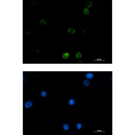 Hexokinase I Rabbit Monoclonal Antibody