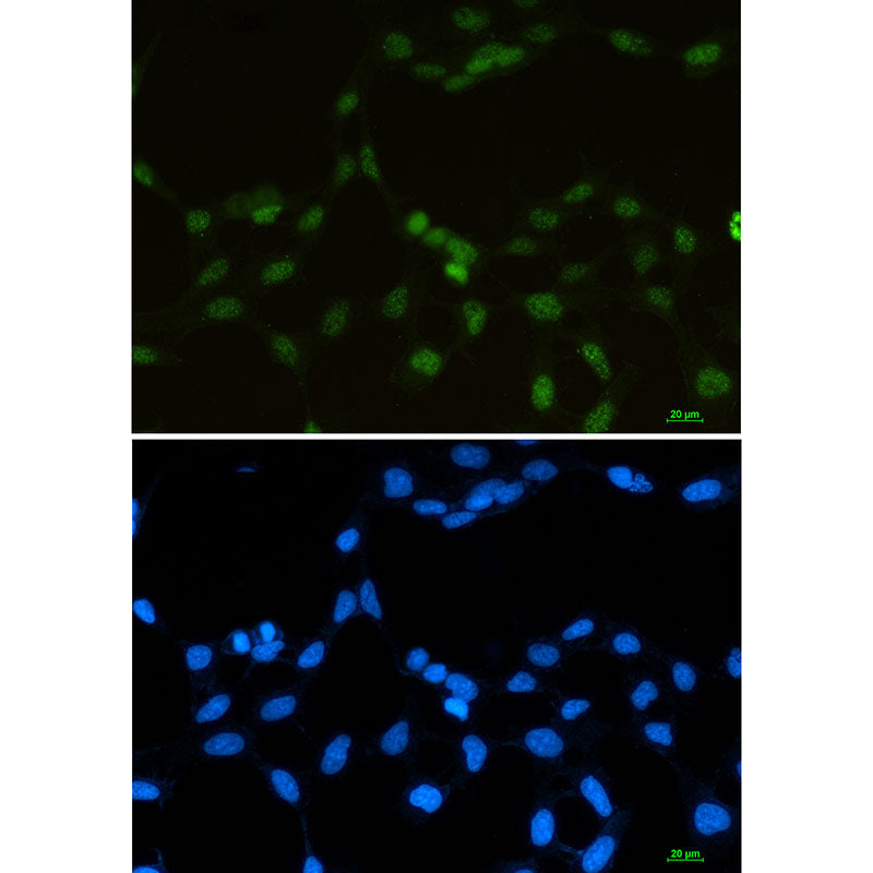 hnRNP G Rabbit Monoclonal Antibody