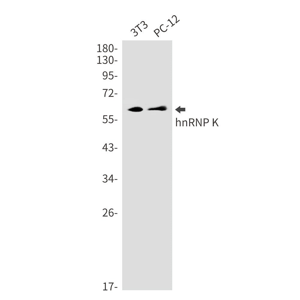hnRNP K Rabbit Monoclonal Antibody