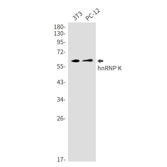 hnRNP K Rabbit Monoclonal Antibody