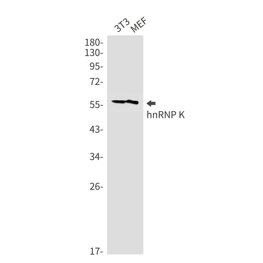 hnRNP K Rabbit Monoclonal Antibody