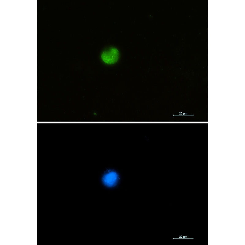 hnRNP M Rabbit Monoclonal Antibody