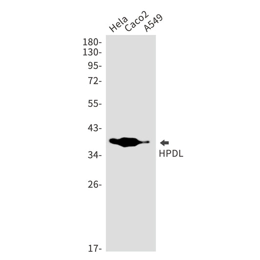 HPDL Rabbit Monoclonal Antibody