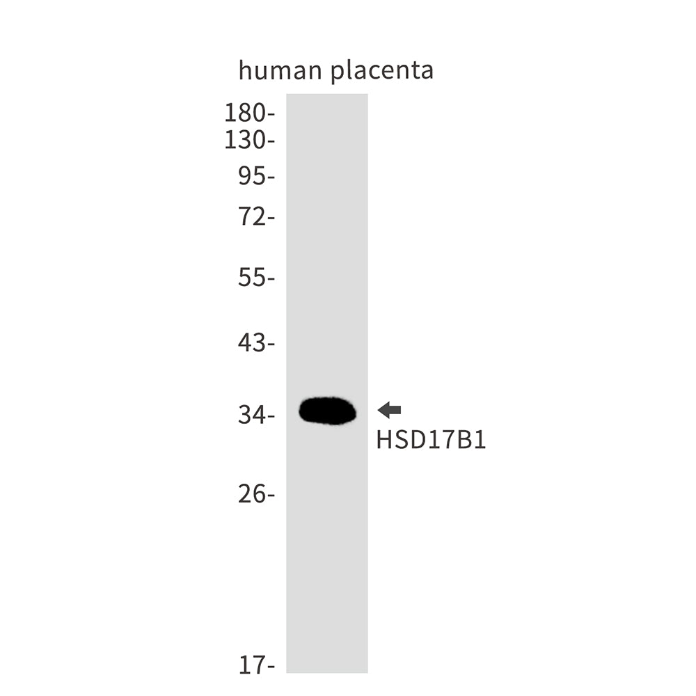 HSD17B1 Rabbit Monoclonal Antibody