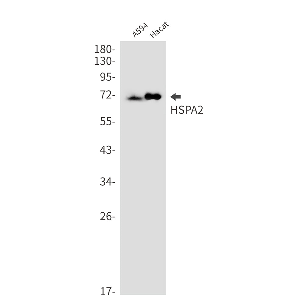 HspA2 Rabbit Monoclonal Antibody