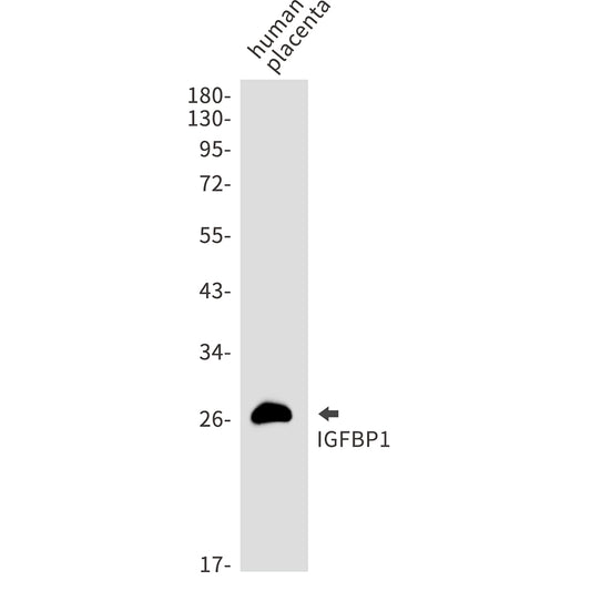 IGFBP1 Rabbit Monoclonal Antibody