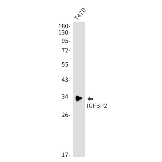 IGFBP2 Rabbit Monoclonal Antibody