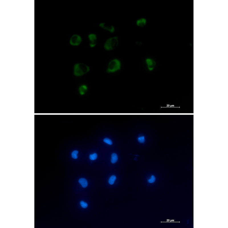 IL-1 Receptor Antagonist Protein Rabbit Monoclonal Antibody