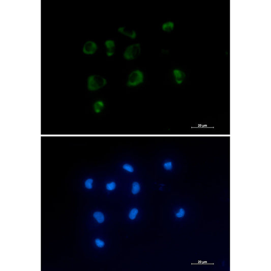 IL-1 Receptor Antagonist Protein Rabbit Monoclonal Antibody