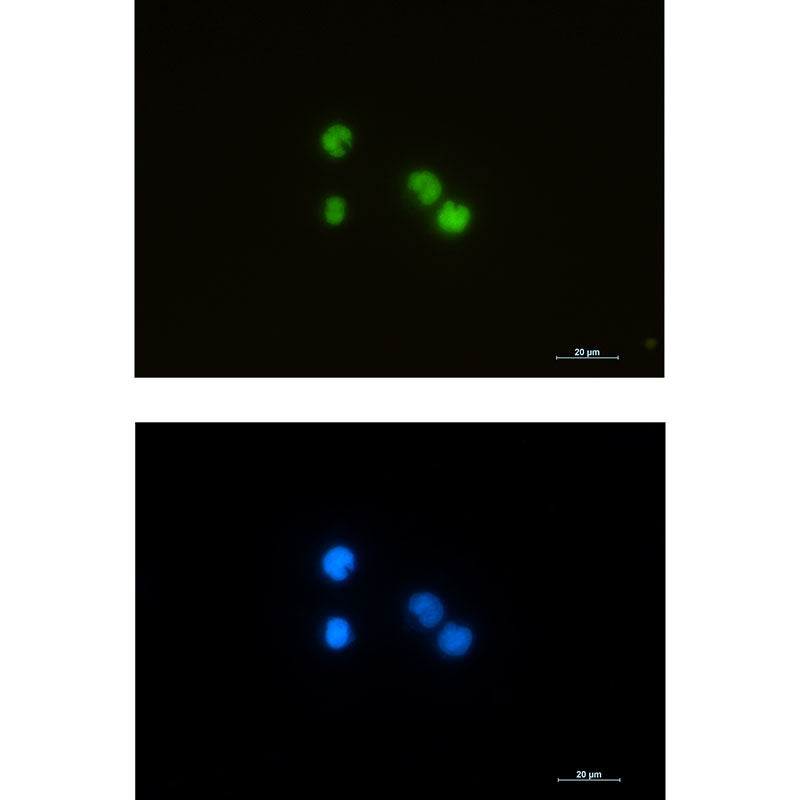 ILF3 Rabbit Monoclonal Antibody
