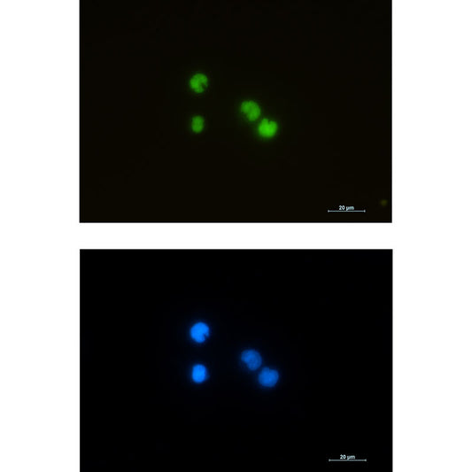 ILF3 Rabbit Monoclonal Antibody
