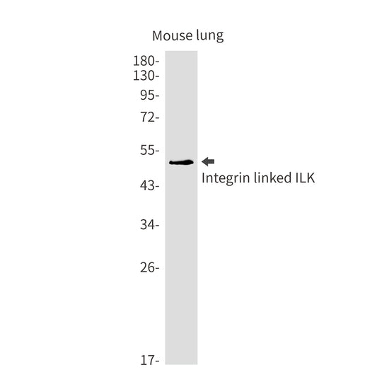 Integrin Linked ILK Rabbit Monoclonal Antibody