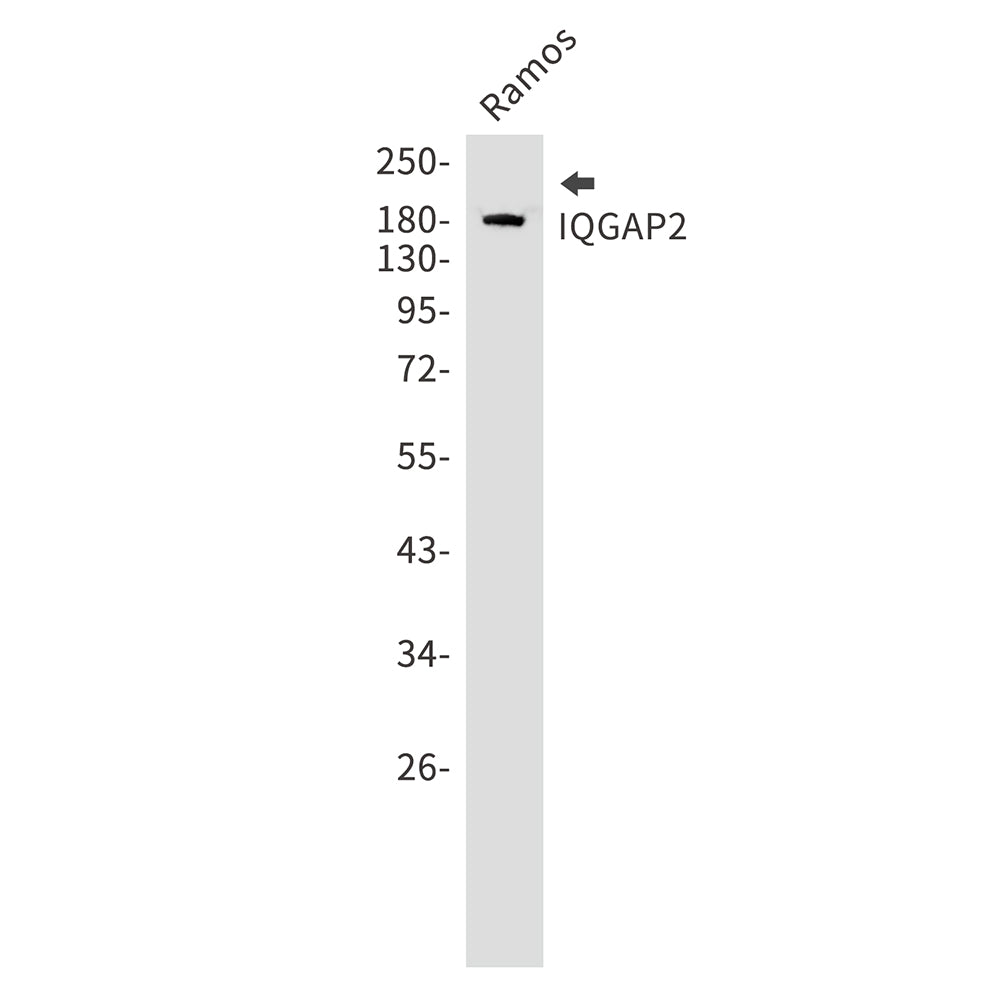 IQGAP2 Rabbit Monoclonal Antibody