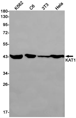 KAT1 Rabbit Monoclonal Antibody