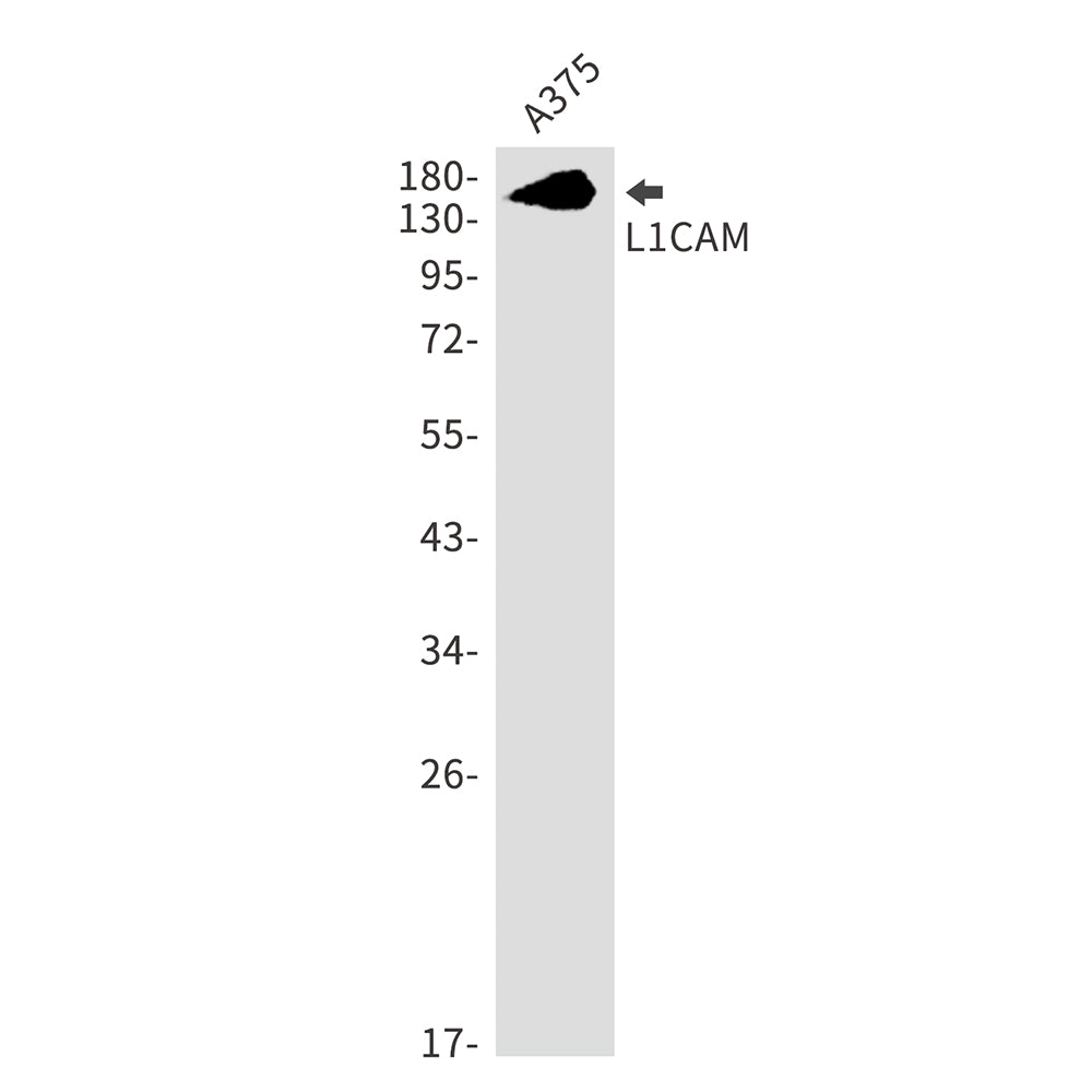 L1CAM Rabbit Monoclonal Antibody