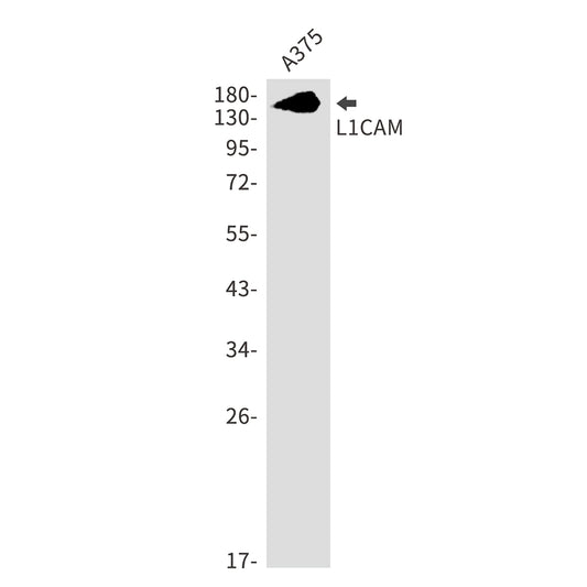 L1CAM Rabbit Monoclonal Antibody