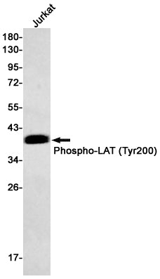 Phospho-LAT (Tyr200) Rabbit Monoclonal Antibody