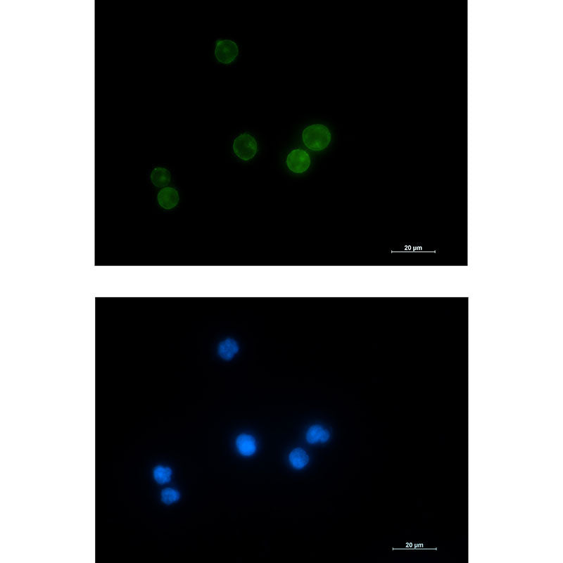 Lck Rabbit Monoclonal Antibody
