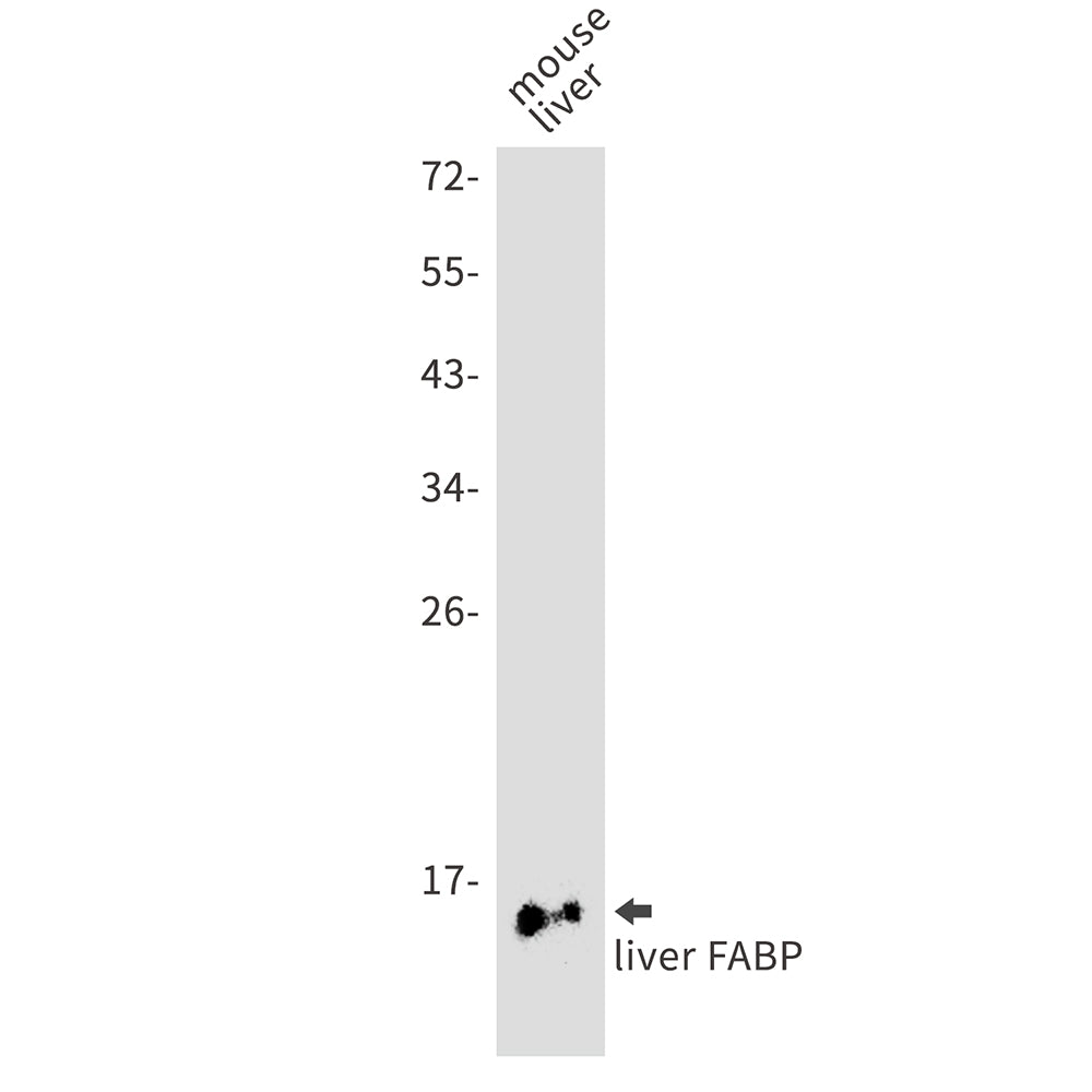 FABP1 Rabbit Monoclonal Antibody