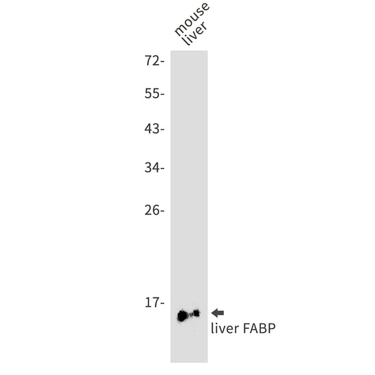 FABP1 Rabbit Monoclonal Antibody